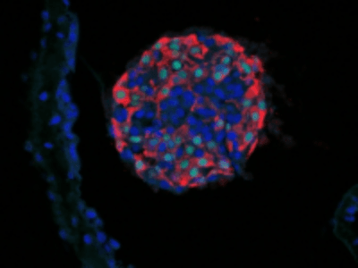 MELTON-ANDERSON TEAM PUBLISHES NEW FINDINGS PROMISING RESULTS IN ANIMALS BUT STILL A LONG WAY TO GO BEFORE TESTING IN HUMANS