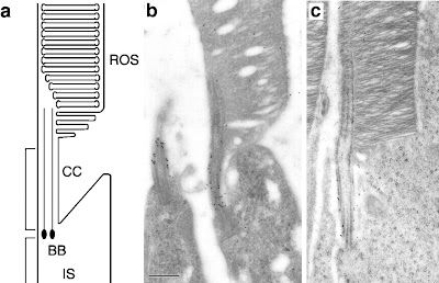 This is a picture of photoreceptors 