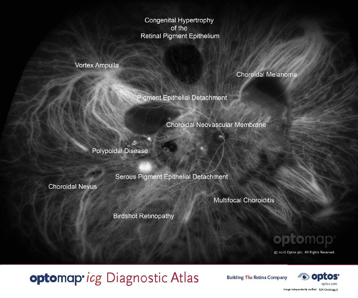 optomap icg Diagnostic Atlas