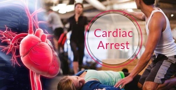 Surviving a Sudden Cardiac Arrest or SCA