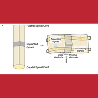 Surface circumferential spinal cord recording in freely moving rodents