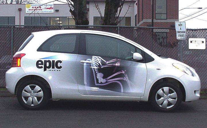 Epic Car