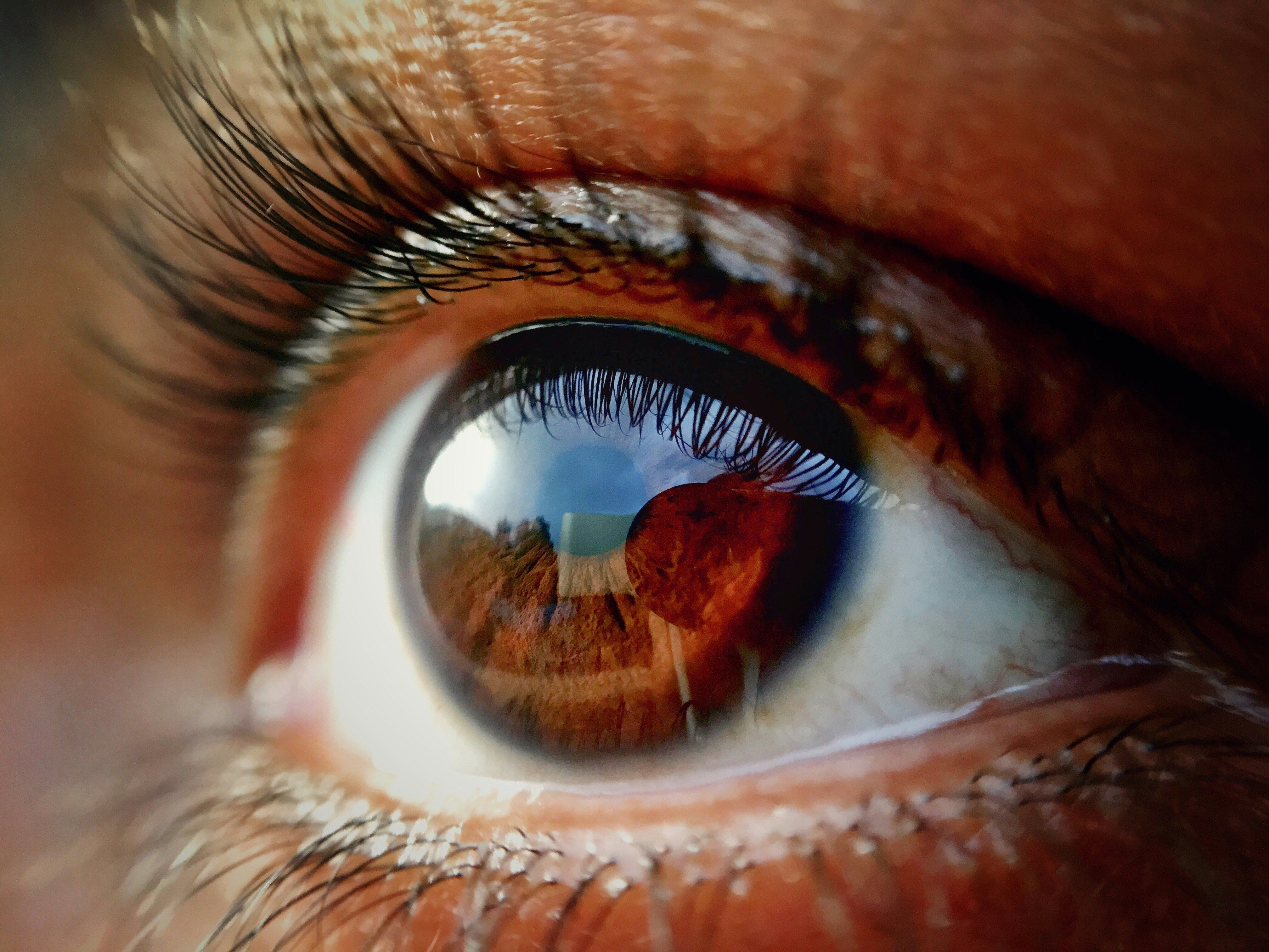 Contact lens fittings and prescriptions