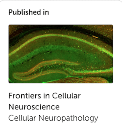 Mast Cells in Neurodegenerative Disease