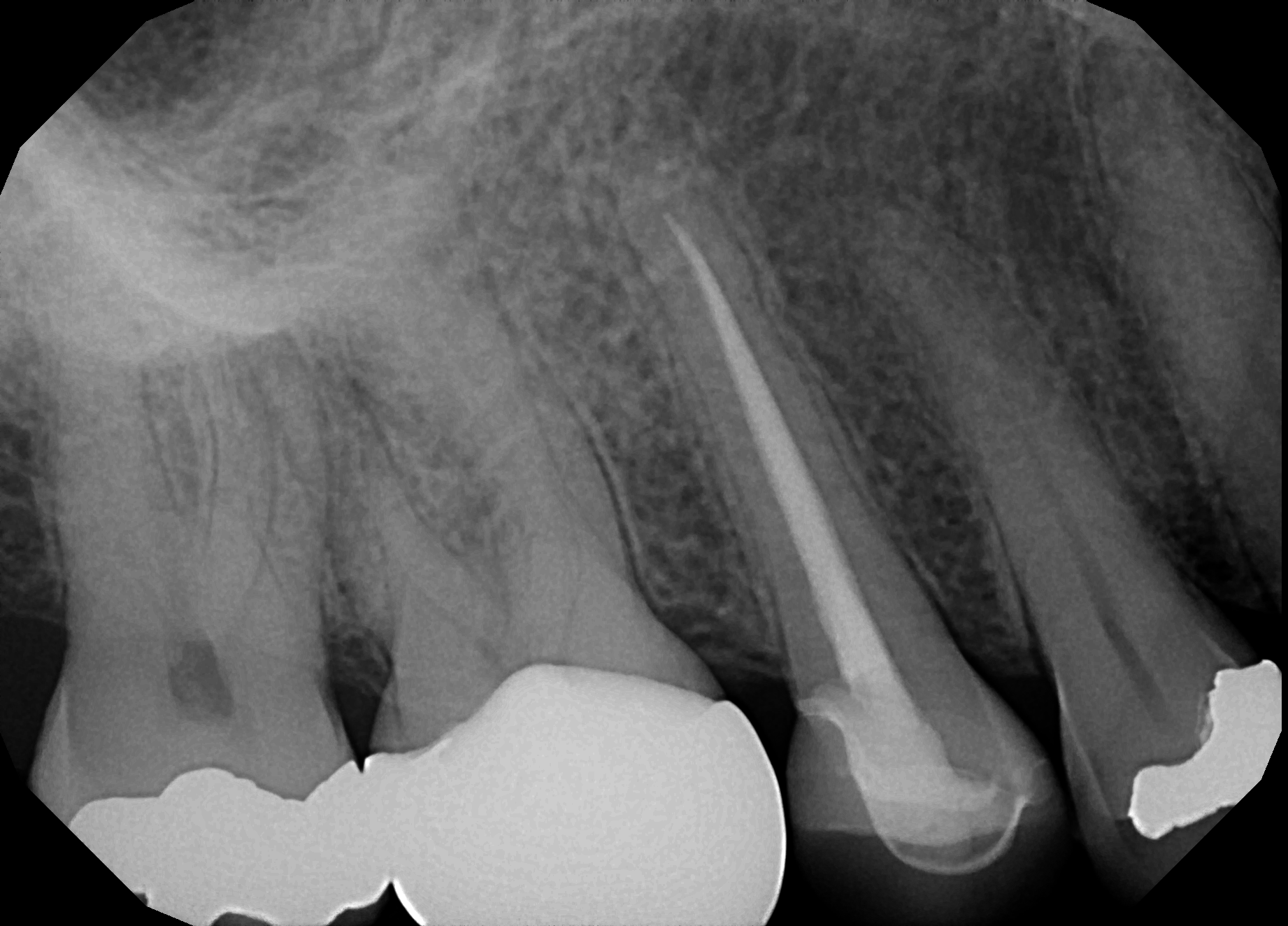 Cornerstone Endodontics Referring Doctors Jamie's Endo Journal Archive Journal Archive 2018