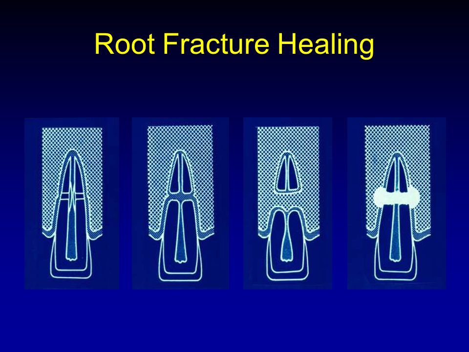 Cornerstone Endodontics Referring Doctors Jamie's Endo Journal Archive Journal Archive 2018