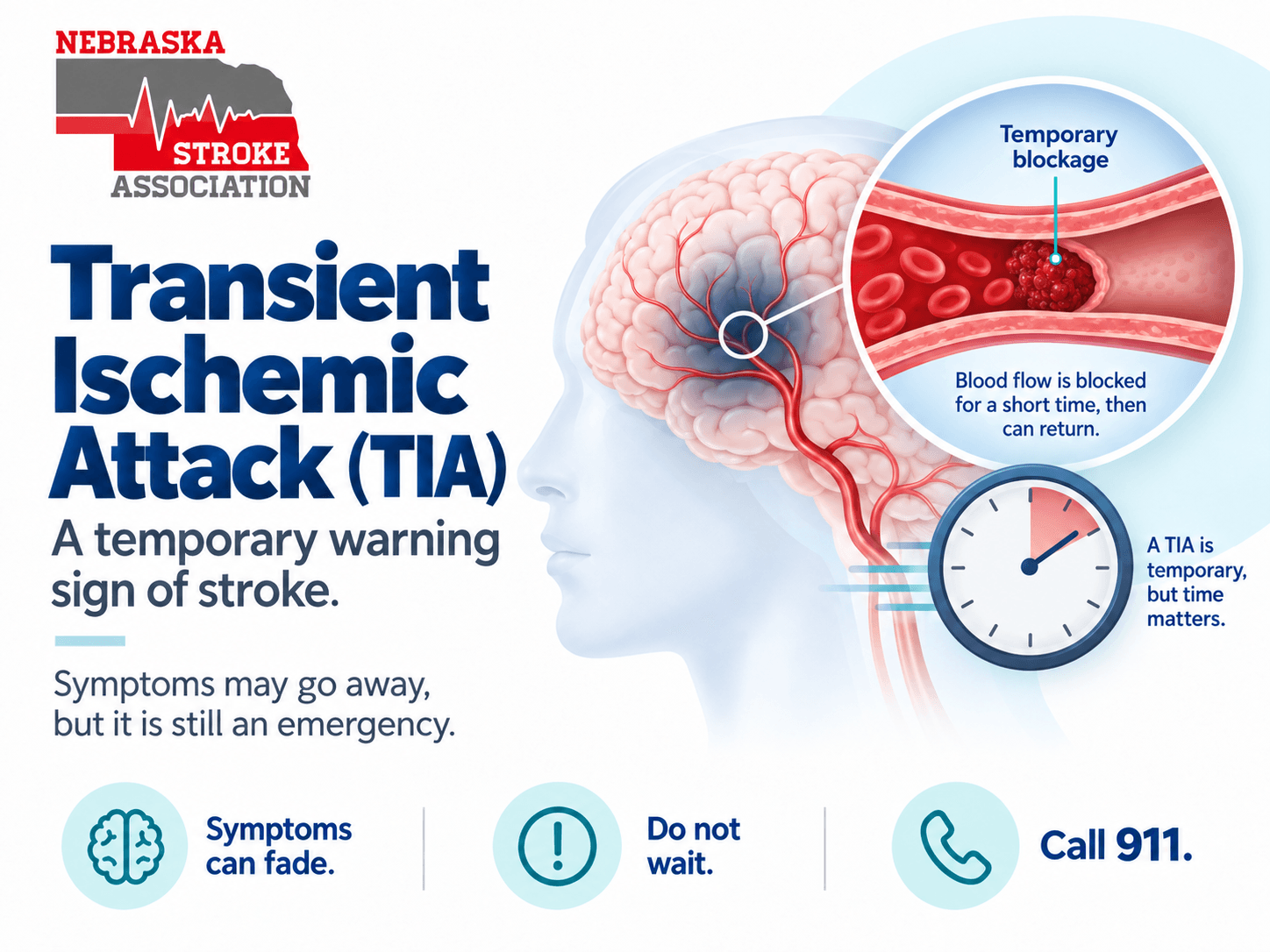Transient Ischemic Attack — TIA