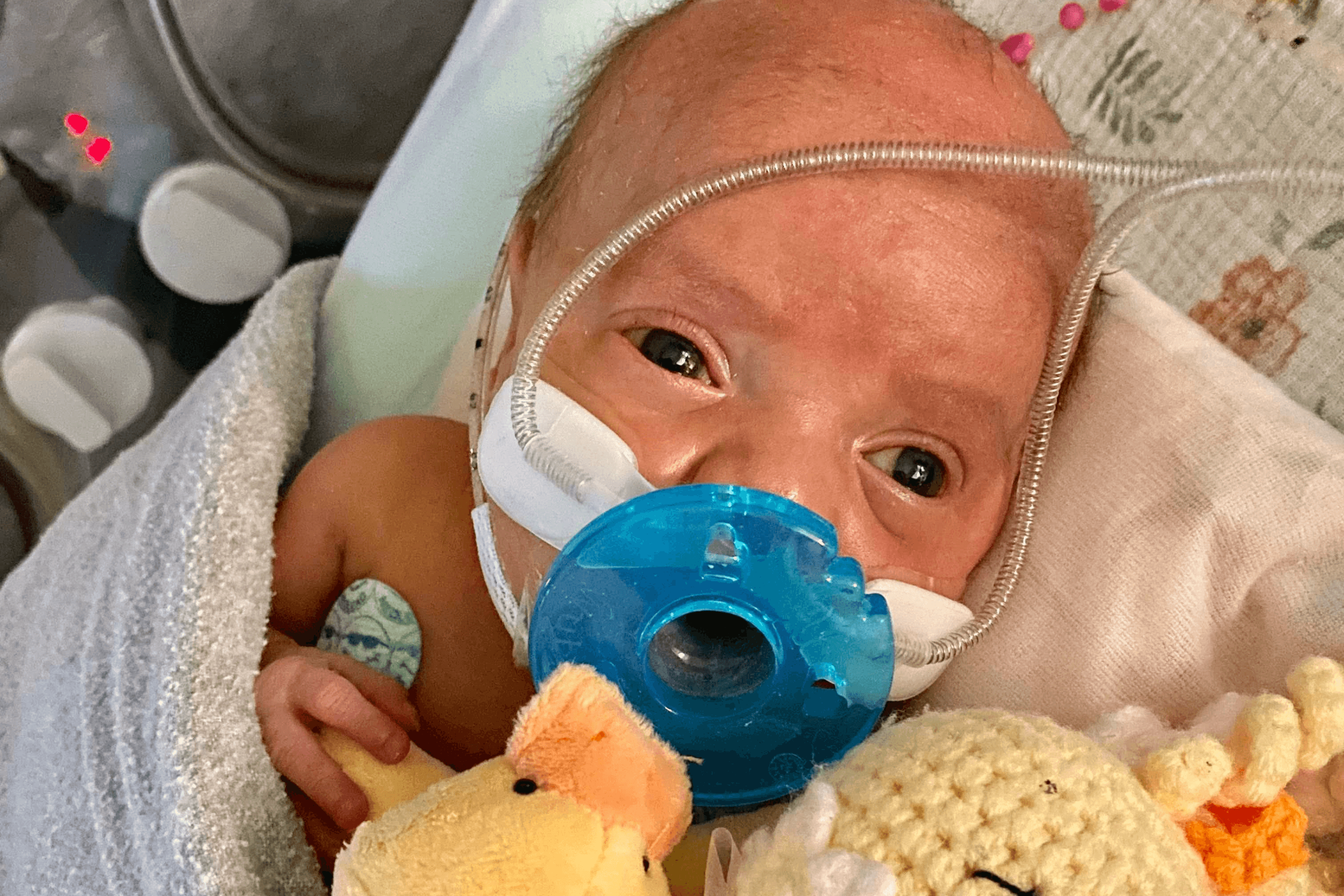 Hope in the NICU: Sophia's Story of Surviving NEC