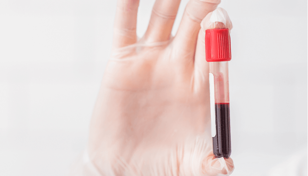 3. GET A FREE, NON-FASTING BLOOD TEST