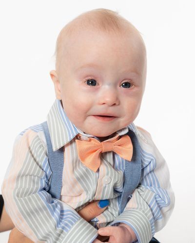 Infant with Down syndrome at therapy for early intervention.