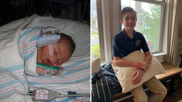 James' CHD Story