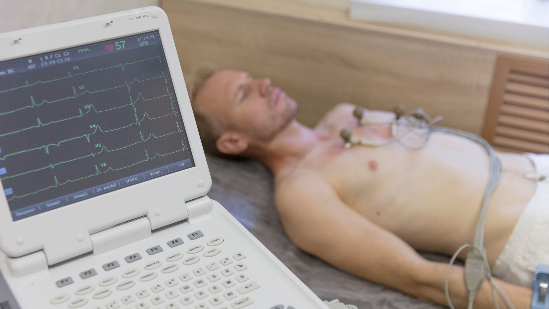 What is an EKG Test