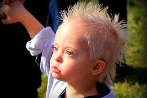 Little, bright blue-eyed boy with Down syndrome.