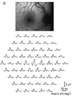 This is a picture of a healthy eye