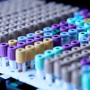test tubes