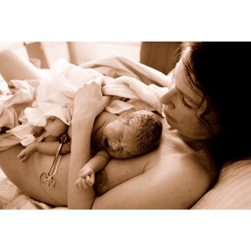 Obstetric Hemorrhage