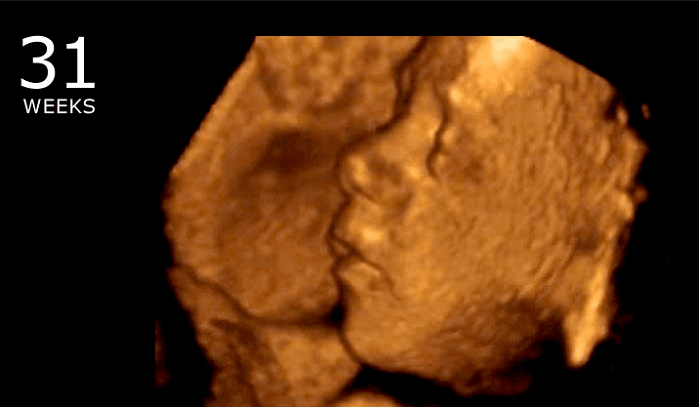 Lubbock, Texas Bans Abortions, Becomes “Sanctuary County for the Unborn”