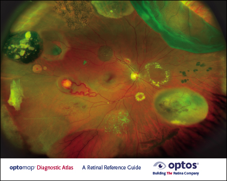 optomap Diagnostic Atlas Retinal Reference Guide (color)