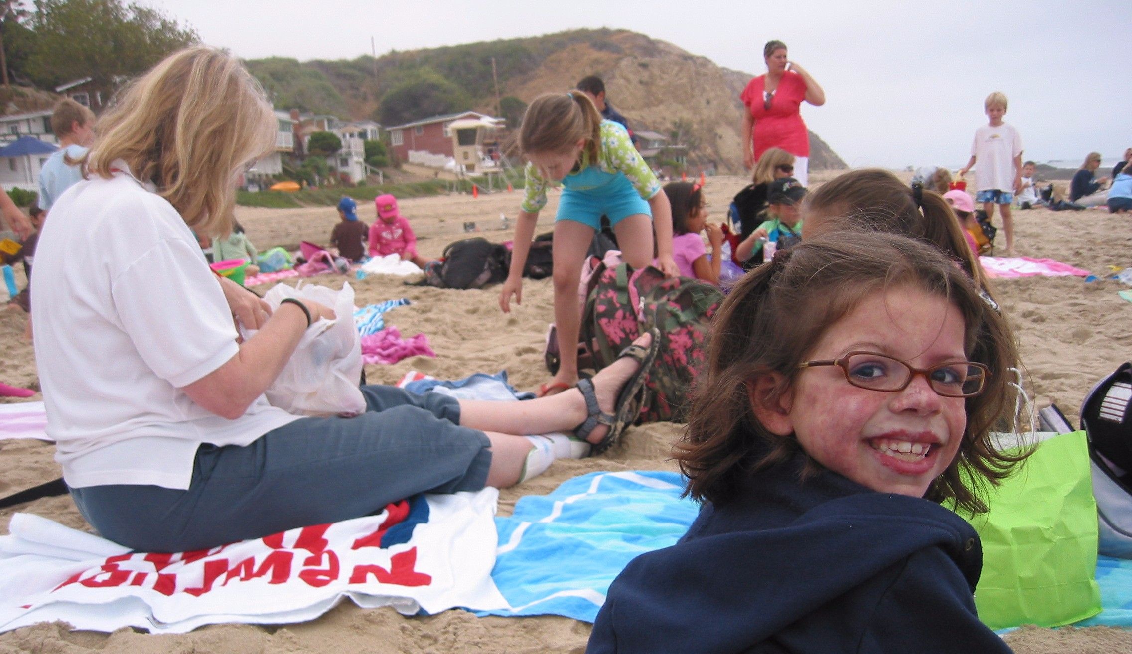 On the beach with a girl in the foreground with Sturge-Weber syndrome