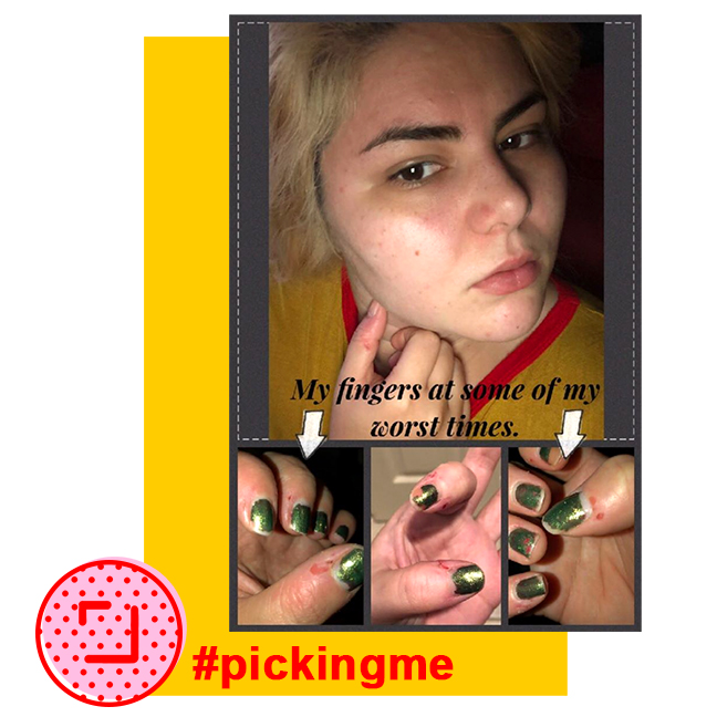 Picking Me Foundation NFP : shareyourstory : ShareYourStory Picking Me Foundation NFP : shareyourstory : ShareYourStory