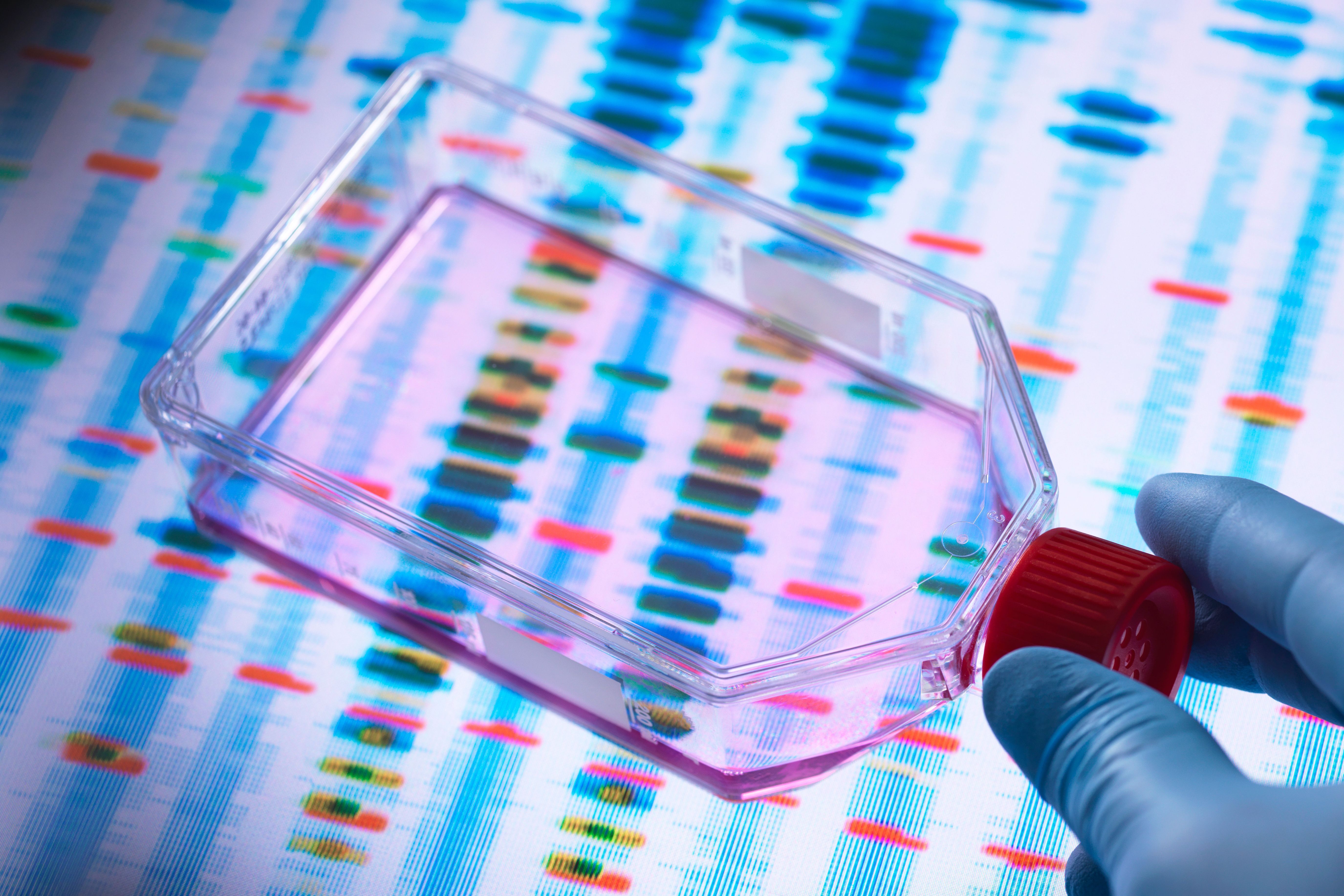 Sana Biotechnology’s 1-Year Results in UP421 Practical Cure Trial