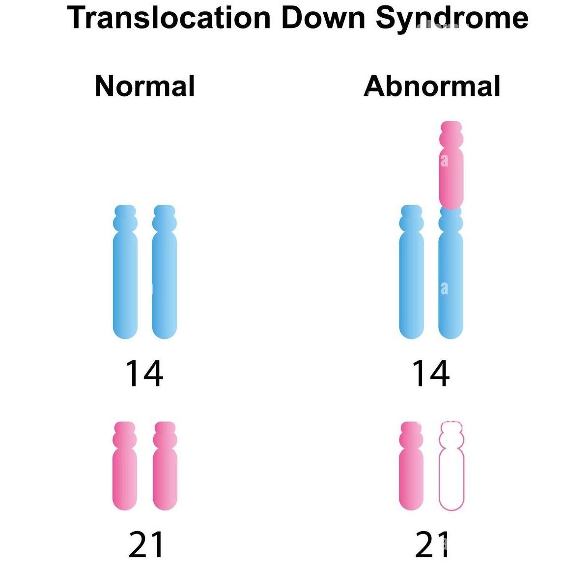 Translocation