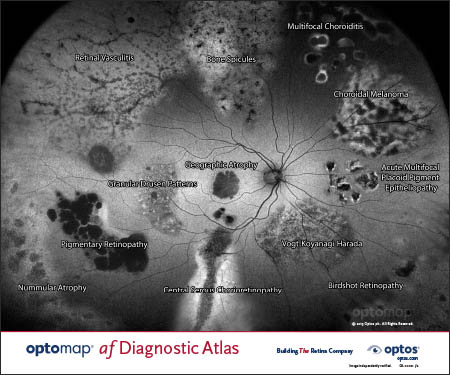 optomap af Diagnostic Atlas