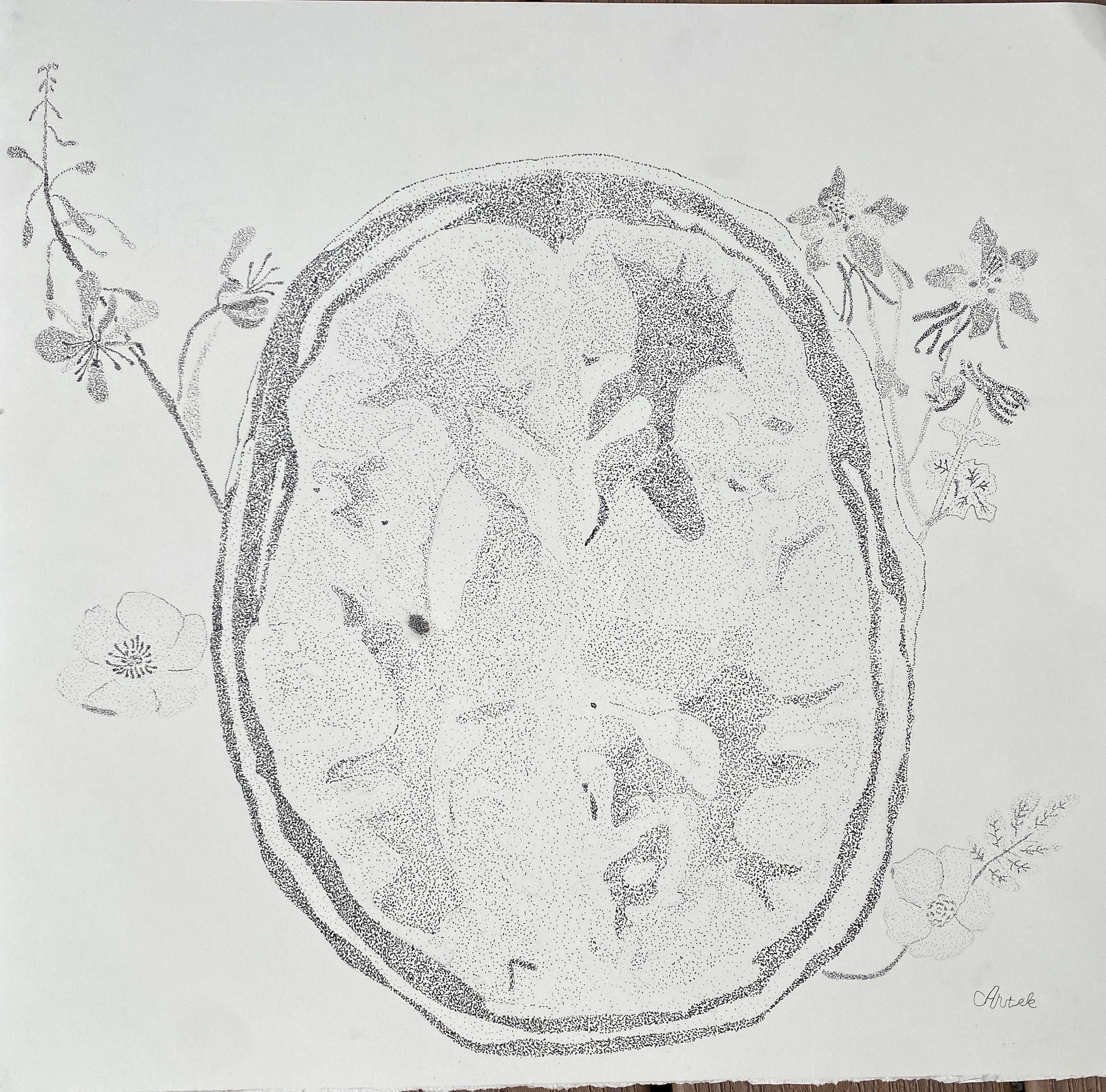 Growing Through Trauma by Artek