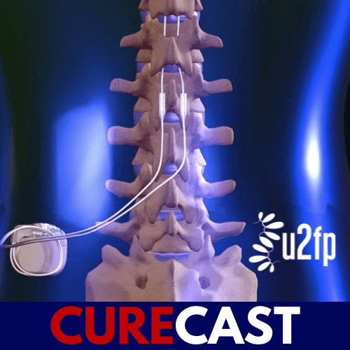 graphic of a spine and a stimulator device with the CureCast logo at bottom