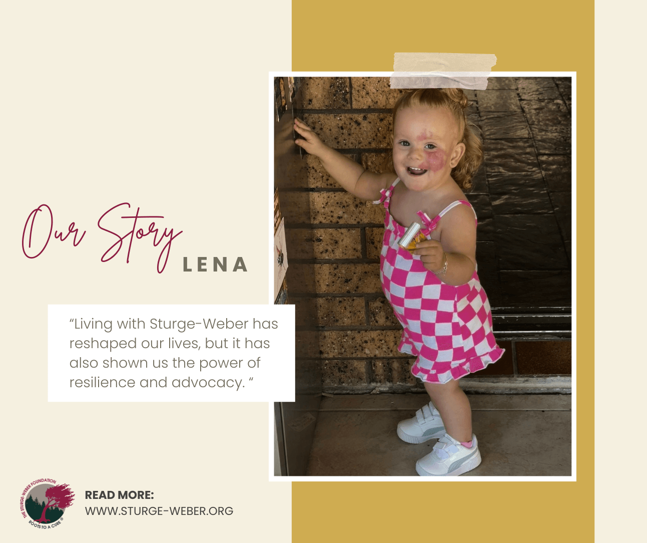 photo of little girl smiling at the camera with sturge-weber