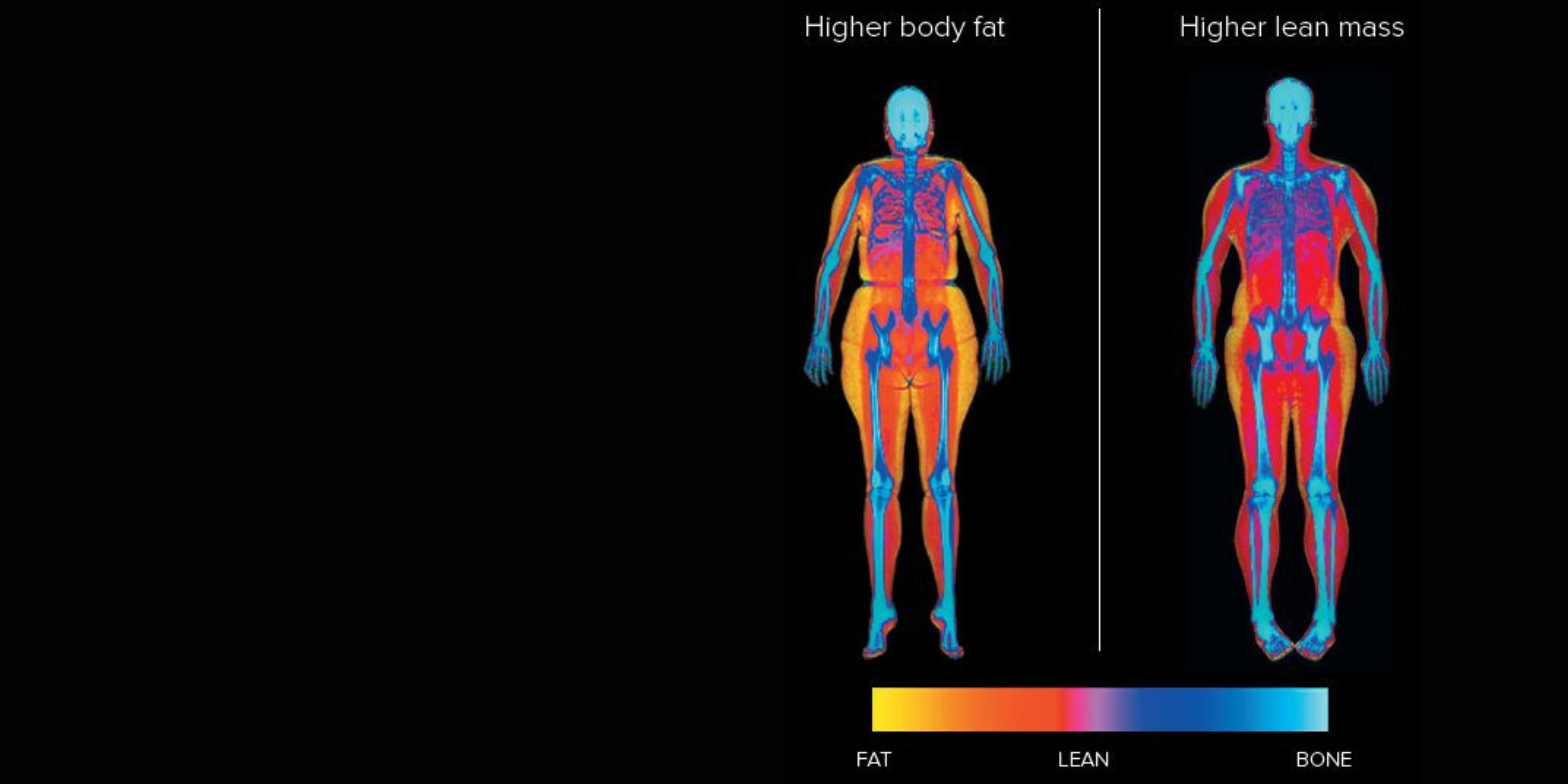 Advanced Body Composition Assessments