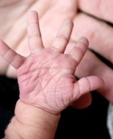The little hand of a child with Down syndrome in the palm of a larger hand.