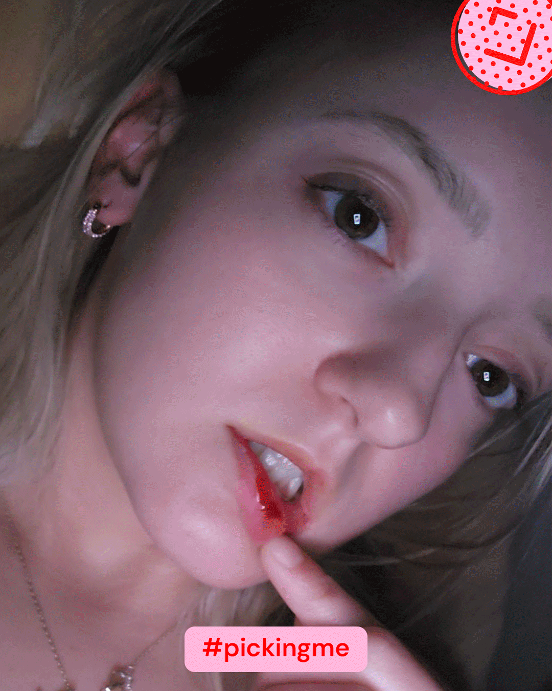 Allison