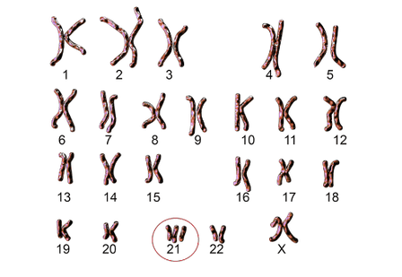Chromosomes 1-22 and x with 21 circled.