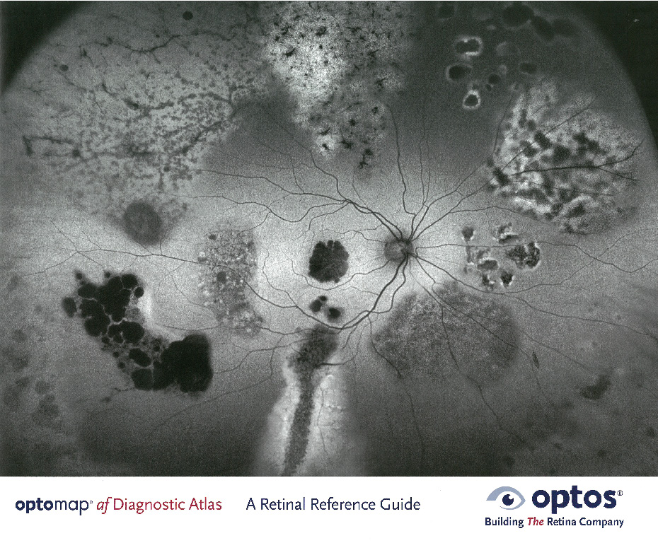 optomap Diagnostic Atlas Retinal Reference Guide (af)