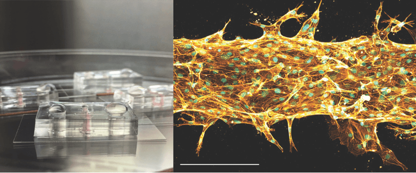 Figure 1. Microfluidic CLA “chips” – each one is about the size of a quarter. On the right is an image of cells within the chip patterned to form a vessel-like tube that is about the width of a human hair (scale bar is 0.15 mm). 