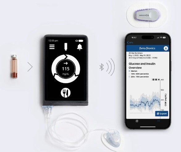 FDA Approves Beta Bionics’ Insulin-Only Device. What about Dual-Hormone?