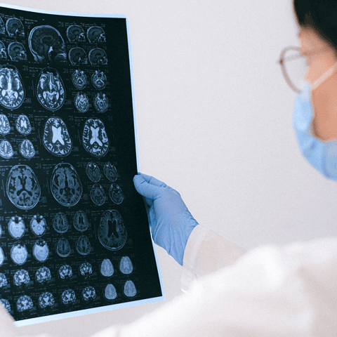 Questions to Ask the Neurologist