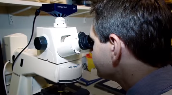 A researcher looks through a microscope to see if a PSC diagnosis is correct.