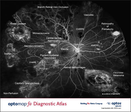 optomap fa Diagnostic Atlas - Poster