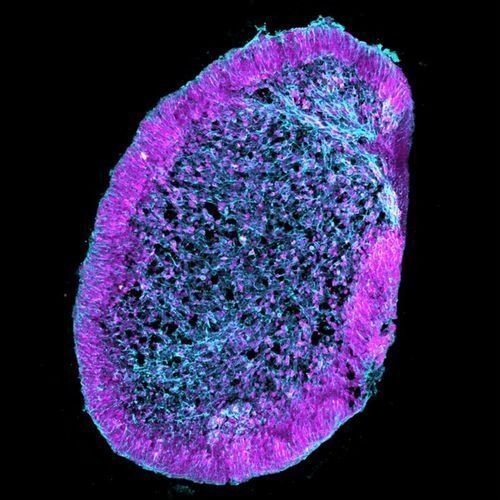Confocal image of a 60-day old retinal organoid derived from human stem cells.  Neurons are stained in blue and retinal progenitor cells are shown in magenta. Credit:  Jingyuan Zhang and Karl Koehler