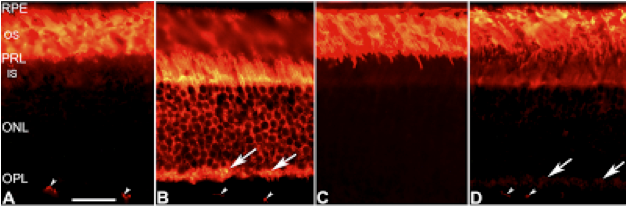 This is a picture of light-dependent protein