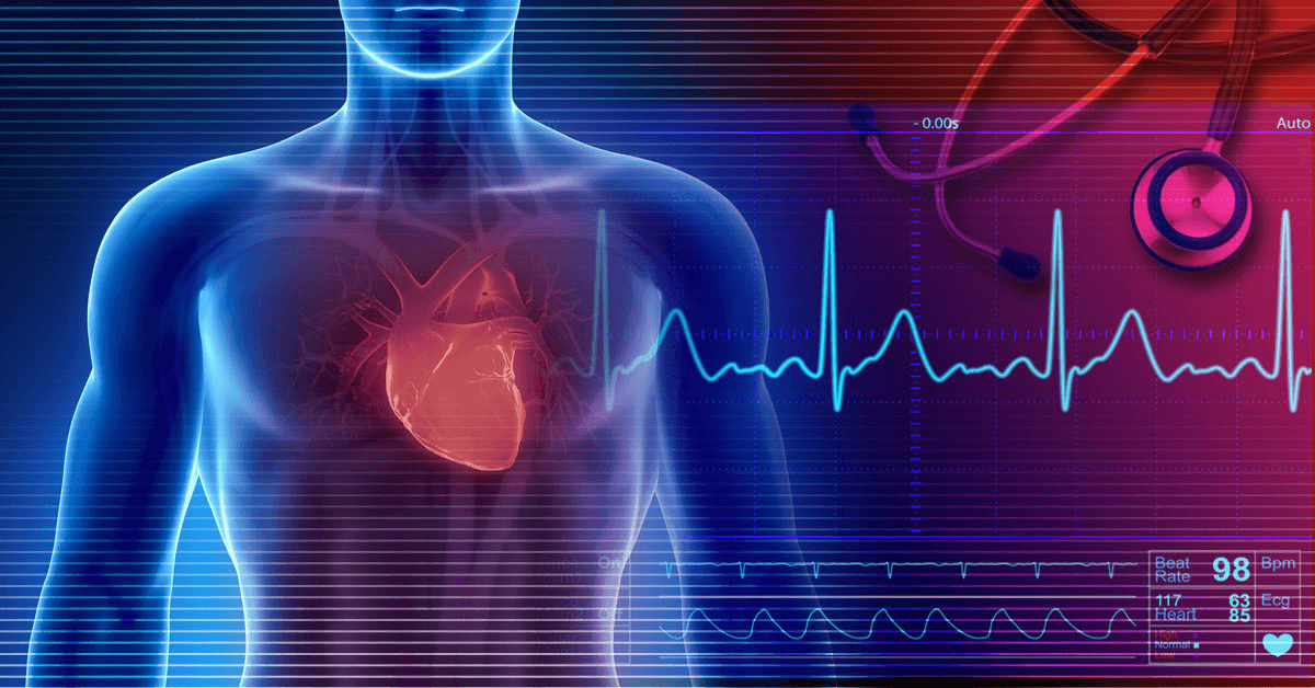 Sudden Cardiac Arrest and Atrial Fibrillation: What’s the Connection?