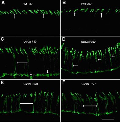 A picture of Opsin protein localization in control and Ush2a mouse photoreceptors