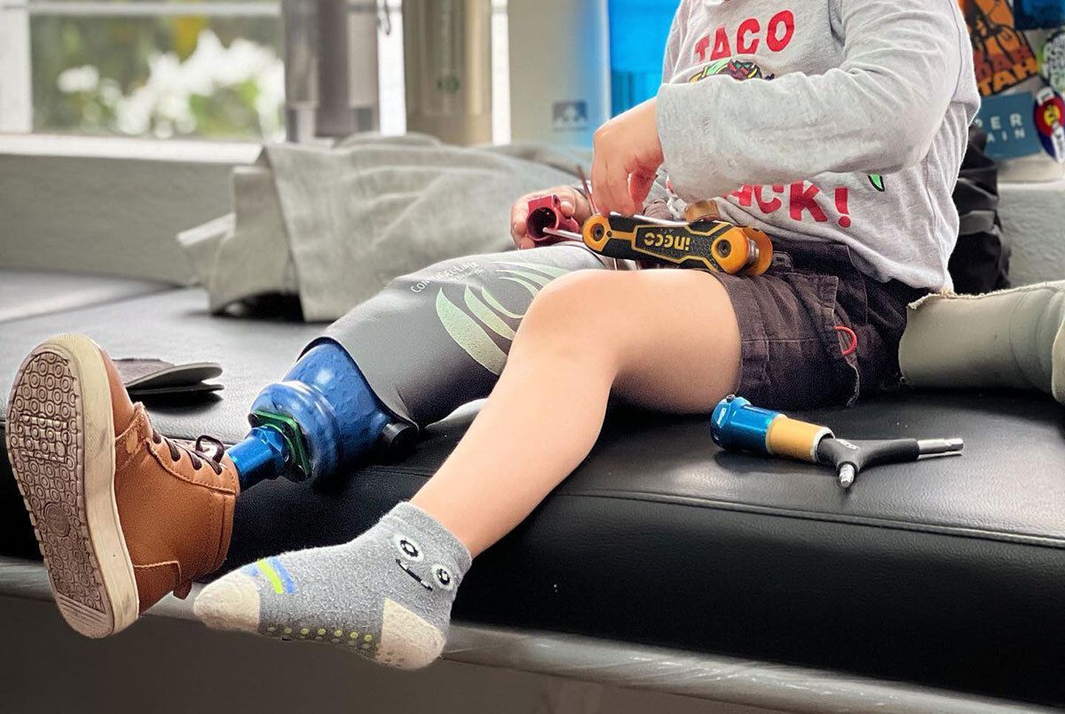 Young boy with a prosthetic leg.
