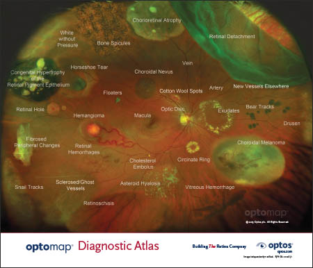 optomap color Diagnostic Atlas - Poster