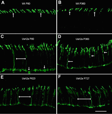 A picture of Opsin protein localization in control and Ush2a mouse photoreceptors