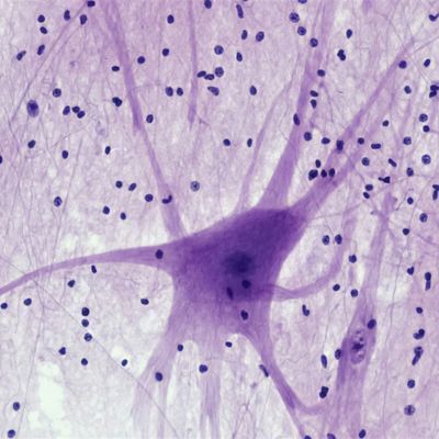 Scientists Grow 3D Lymphatic Tissues from Patient Biopsies