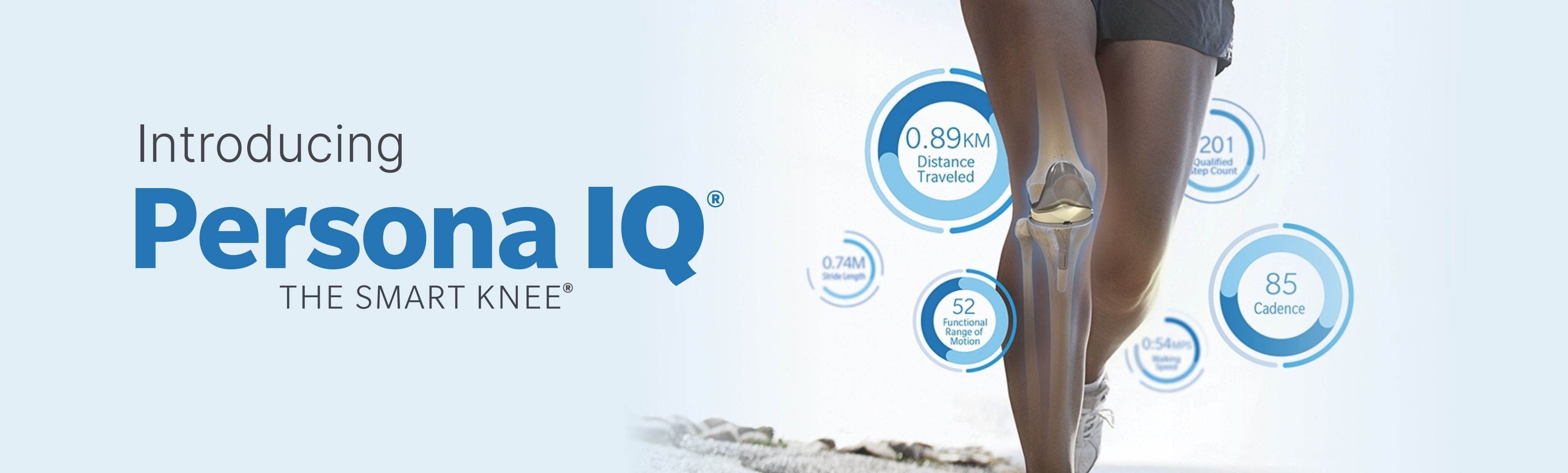 Persona IQ Knee Implant