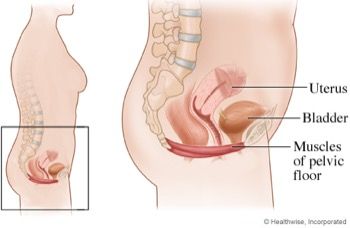 Urinary Incontinence during Pregnancy - Husker Rehab & Wellness